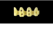 Cod.E1 f Upper Anterior: 10x  hollow pontics blocks-frames, (12-22), carved to fit into wax veneers Cod.E1Upper Anterior, LARGE, (13-23), for porcelain pressed to metal bridgework